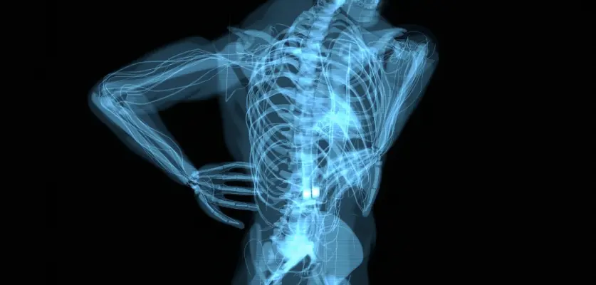 Lazerle Bel Fıtığı Ameliyatı